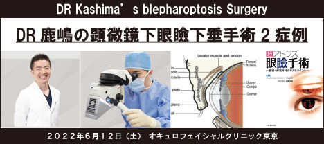 DR鹿嶋の顕微鏡下眼瞼下垂手術2症例